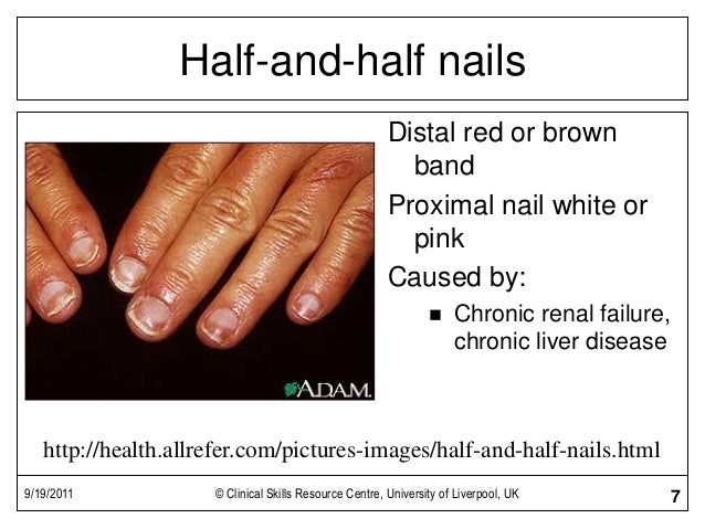 Basic Examination Of The Hands Basic Examination Of The Hands