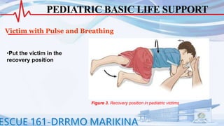 Bls Compression Position BASIC-LIFE-SUPPORT-REV-2021(1).pptx