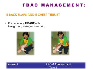 F B A O M A N A G E M E N T :
5 BACK SLAPS AND 5 CHEST THRUST
• For conscious INFANT with
foreign body airway obstruction.
Session 3 FBAO Management
Part 1
 