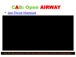 • Jaw-Thrust Maneuve
r
CAB: Open AIRWAY
Note: The video presentation is only for demonstration purposes and not for any advertisements.
 