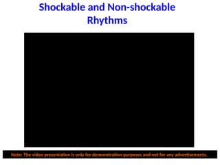 Shockable and Non-shockable
Rhythms
Note: The video presentation is only for demonstration purposes and not for any advertisements.
VF
 