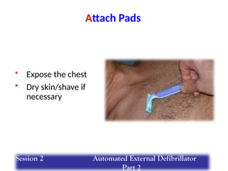 Attach Pads
• Expose the chest
• Dry skin/shave if
necessary
Session 2 Automated External Defibrillator
Part 2
 