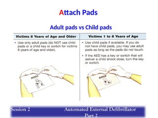 Adult pads vs Child pads
Attach Pads
Session 2 Automated External Defibrillator
Part 2
 