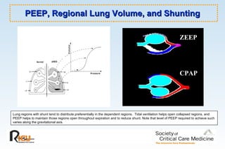 PEEP, Regional Lung Volume, and Shunting Lung regions with shunt tend to distribute preferentially in the dependent regions.  Tidal ventilation helps open collapsed regions, and PEEP helps to maintain those regions open throughout expiration and to reduce shunt. Note that level of PEEP required to achieve such varies along the gravitational axis.  ZEEP CPAP 