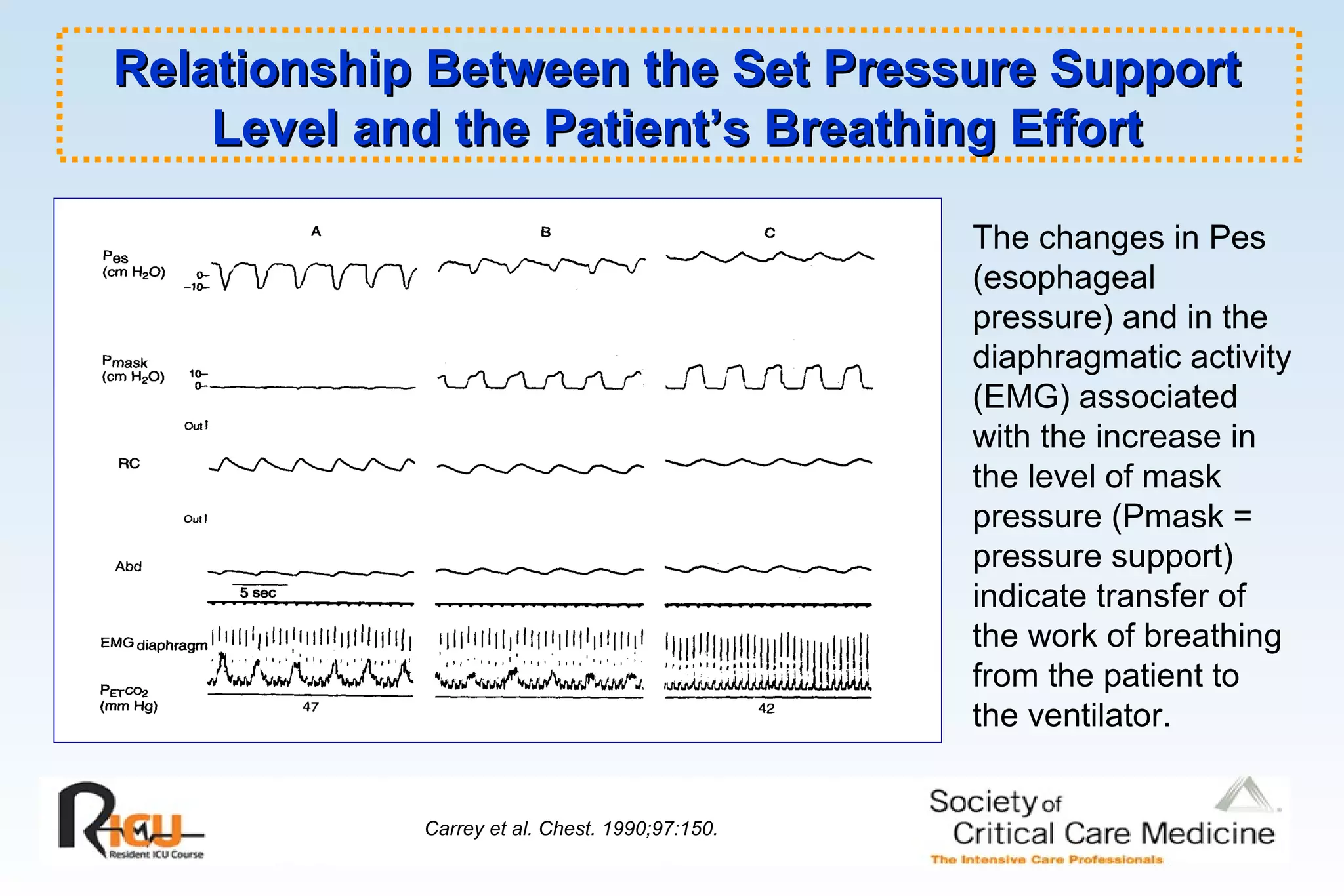 Relationship Between the Set Pressure SupportRelationship Between the Set Pressure Support
Level and the Patient’s Breathing EffortLevel and the Patient’s Breathing Effort
Carrey et al. Chest. 1990;97:150.
The changes in Pes
(esophageal
pressure) and in the
diaphragmatic activity
(EMG) associated
with the increase in
the level of mask
pressure (Pmask =
pressure support)
indicate transfer of
the work of breathing
from the patient to
the ventilator.
 