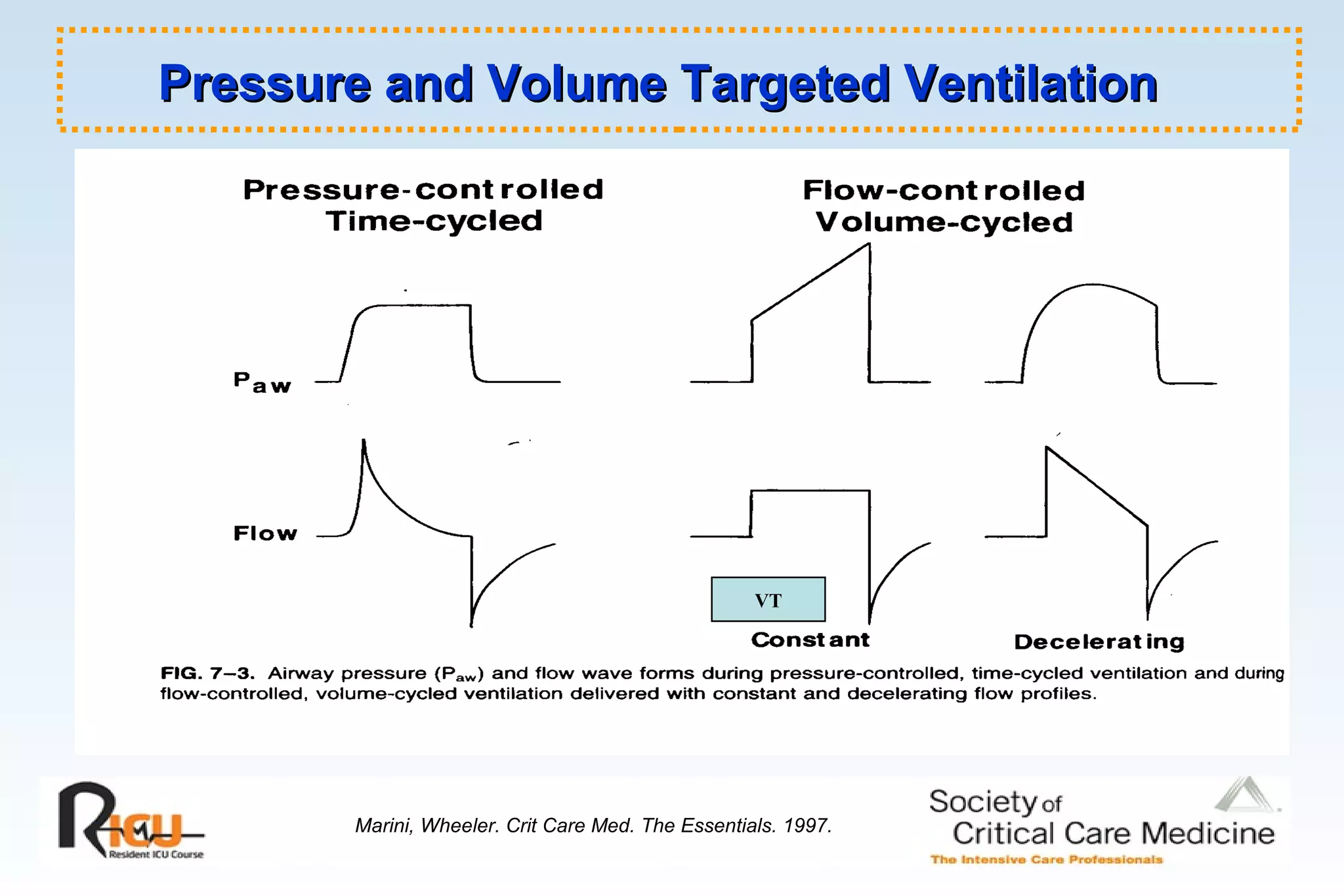 Pressure and Volume Targeted VentilationPressure and Volume Targeted Ventilation
Marini, Wheeler. Crit Care Med. The Essentials. 1997.
VT
 