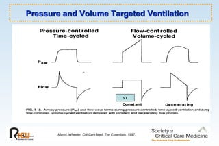 Pressure and Volume Targeted VentilationPressure and Volume Targeted Ventilation
Marini, Wheeler. Crit Care Med. The Essentials. 1997.
VT
 