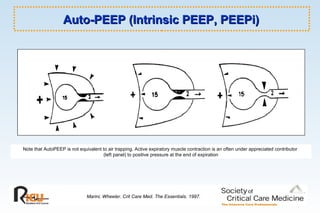 Auto-PEEP (Intrinsic PEEP, PEEPi)Auto-PEEP (Intrinsic PEEP, PEEPi)
Marini, Wheeler. Crit Care Med. The Essentials. 1997.
Note that AutoPEEP is not equivalent to air trapping. Active expiratory muscle contraction is an often under appreciated contributor
(left panel) to positive pressure at the end of expiration
 