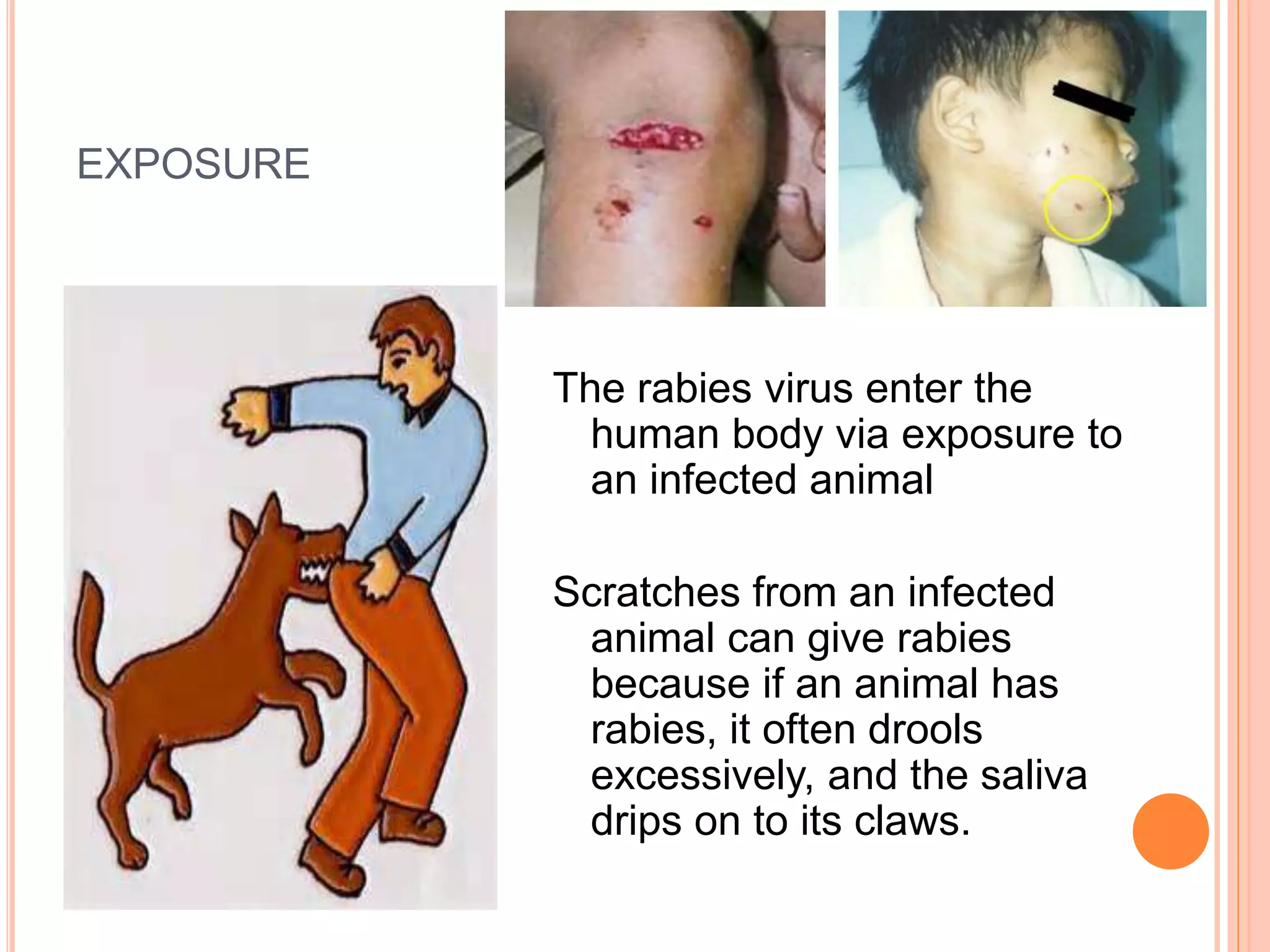 Basic rabies-for-dep ed | PPTX