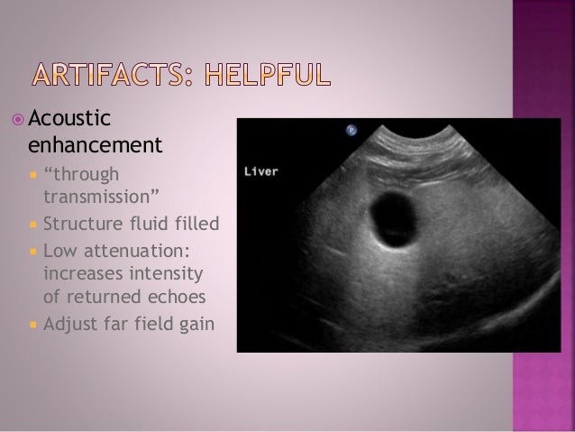 How Often To Change Transmission Fluid >> Abdominal Ultrasound, Dr. Kristina Wilson, 4/5/14 How Often To Change Transmission Fluid >> Abdominal Ultrasound, Dr. Kristina Wilson, 4/5/14