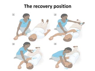 Right Recovery Position Basic Airway management.pptx