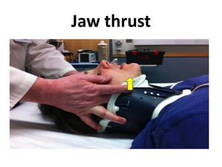 Jaw thrust
 