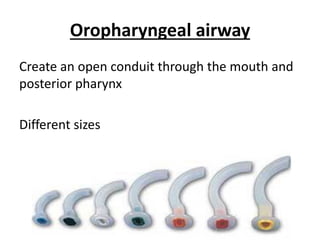 Oropharyngeal airway
Create an open conduit through the mouth and
posterior pharynx
Different sizes
 