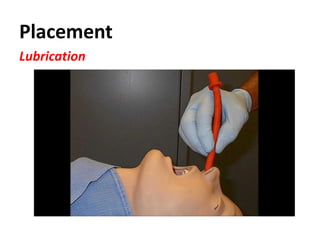 Placement
Lubrication
 