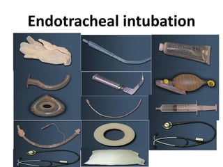 Endotracheal intubation
 