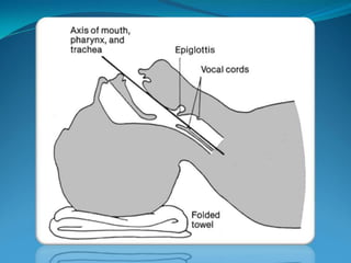 Basic airway management 