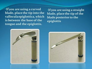 Basic airway management 
