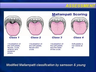 Basic airway management 