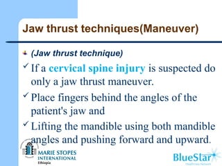 Jaw thrust techniques(Maneuver)
(Jaw thrust technique)
 If a cervical spine injury is suspected do
only a jaw thrust maneuver.
 Place fingers behind the angles of the
patient's jaw and
 Lifting the mandible using both mandible
angles and pushing forward and upward.
 