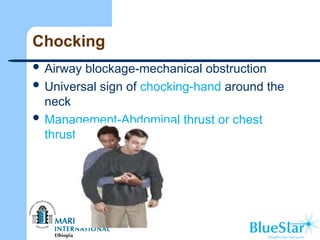 Chocking
 Airway blockage-mechanical obstruction
 Universal sign of chocking-hand around the
neck
 Management-Abdominal thrust or chest
thrust
 