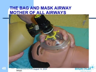 THE BAG AND MASK AIRWAY
MOTHER OF ALL AIRWAYS
August 14, 2024
48
 