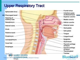 Slide 13.3b
Copyright © 2003 Pearson Education, Inc. publishing as Benjamin Cummings
Figure 13.2
Upper Respiratory Tract
Upper Respiratory Tract
 