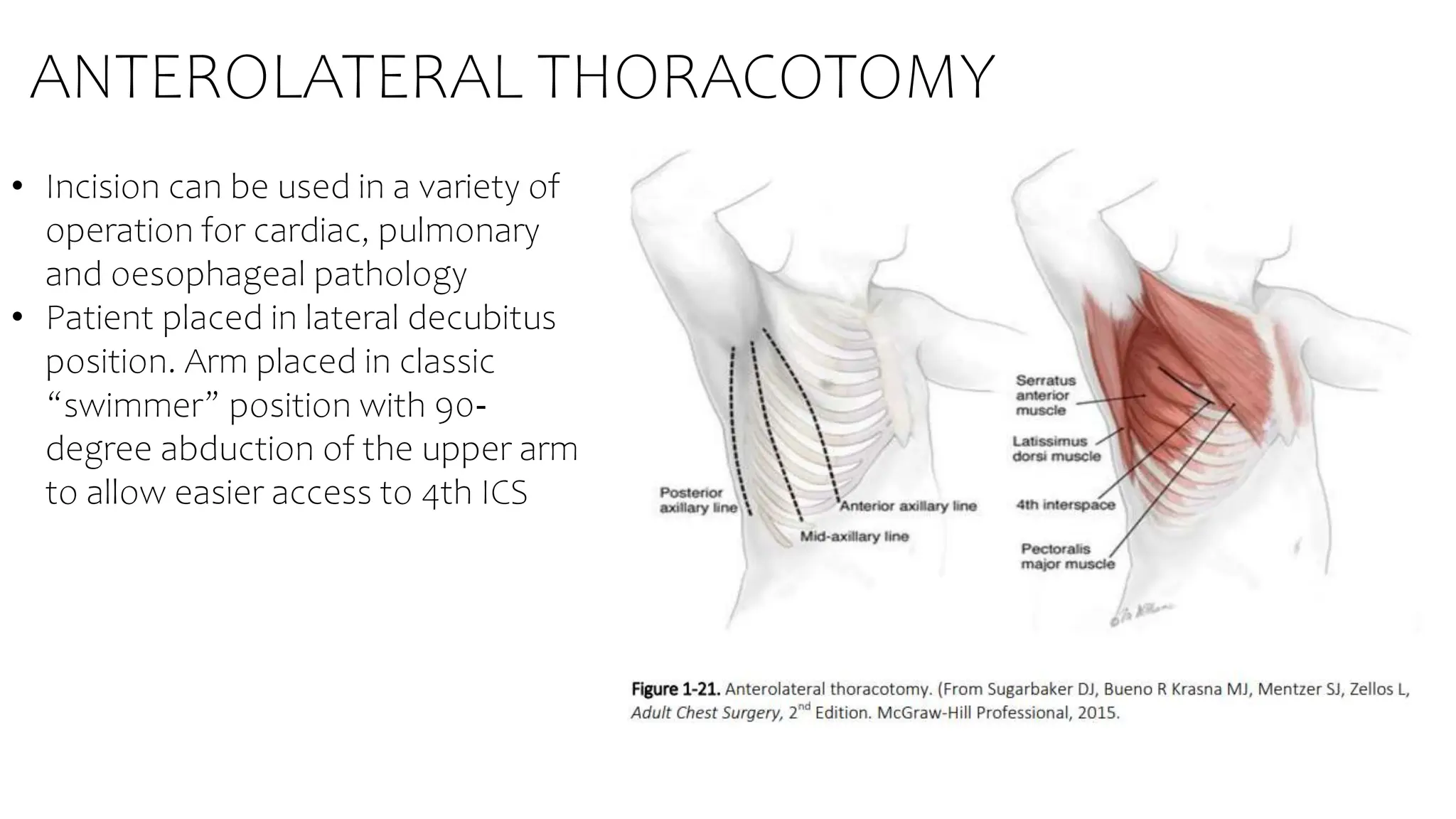 Lateral Incision Meaning basic anatomi for toracic surgery 1.pptx