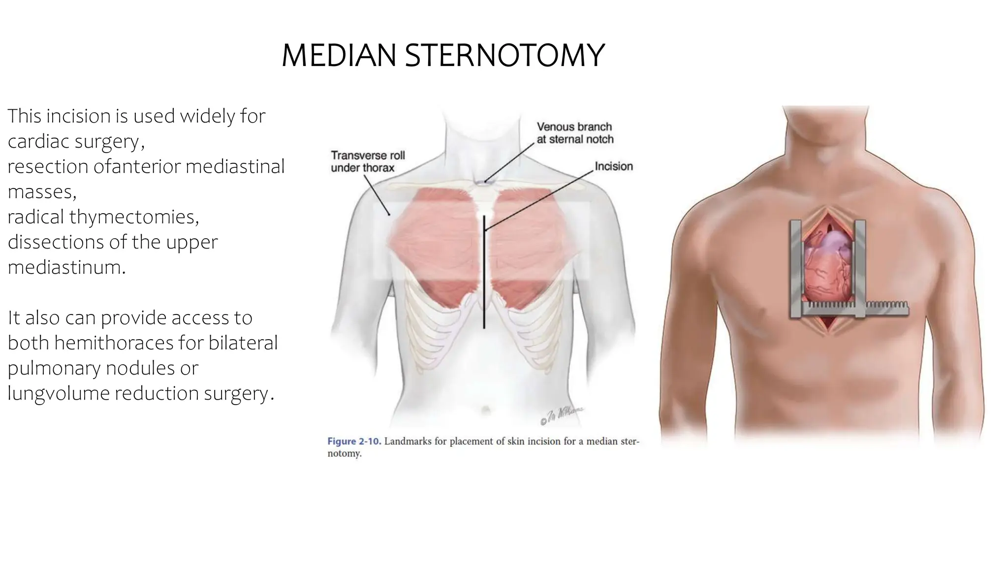 basic anatomi for toracic surgery 1.pptx