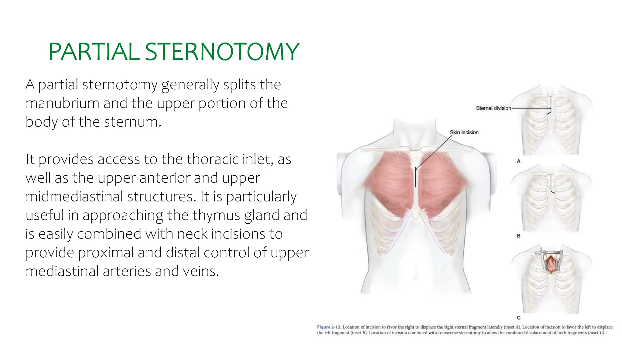 basic anatomi for toracic surgery 1.pptx