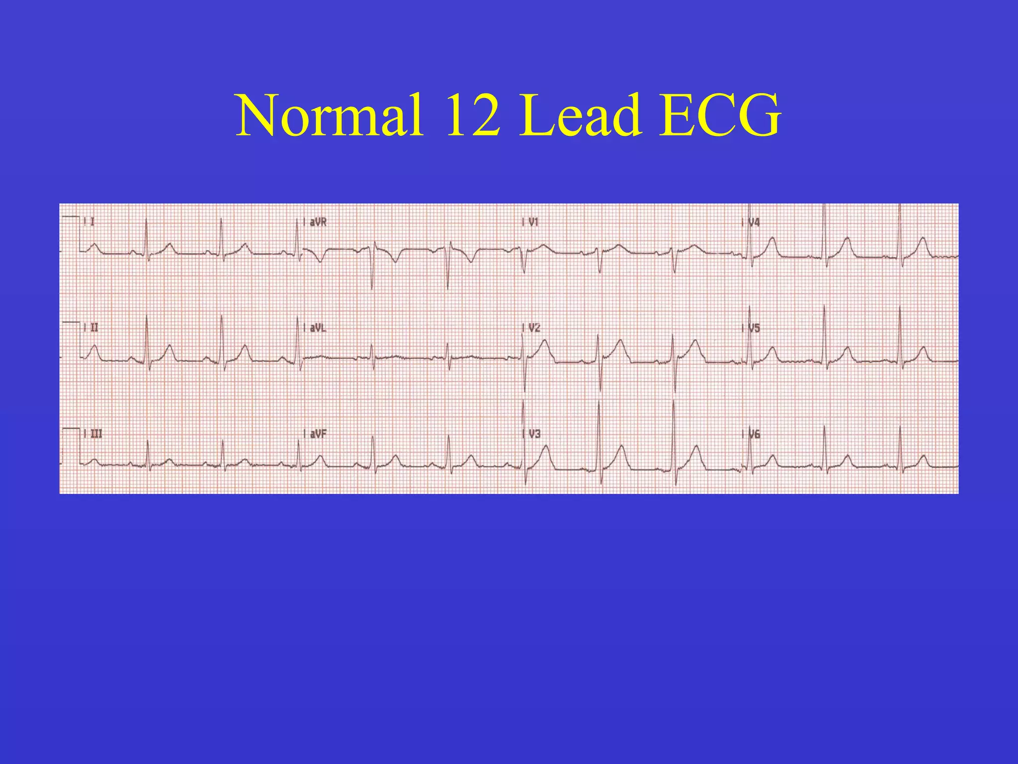 Cardio Vascular Anatomy ECG PPT