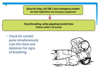  Check for carotid
pulse simultaneously
scan the chest and
abdomen for signs
of breathing.
 