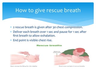  2 rescue breath is given after 30 chest compression.
 Deliver each breath over 1 sec and pause for 1 sec after
first breath to allow exhalation.
 End point is visible chest rise.
How to give rescue breath
 