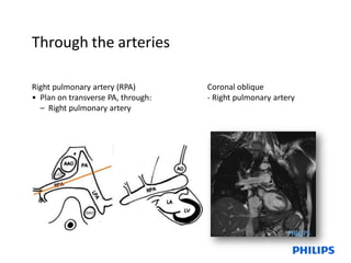 Basic and Advance Cardiac Planning.pdf