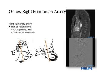 Basic and Advance Cardiac Planning.pdf