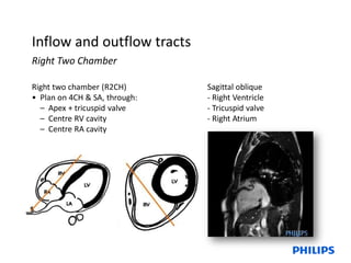 Basic and Advance Cardiac Planning.pdf