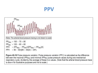 Ppv Optometry Basic and advanced Cardiovascular monitoring.pptx