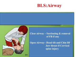 Bls Injury Basic and advanced life support(BLS)-1.pptx