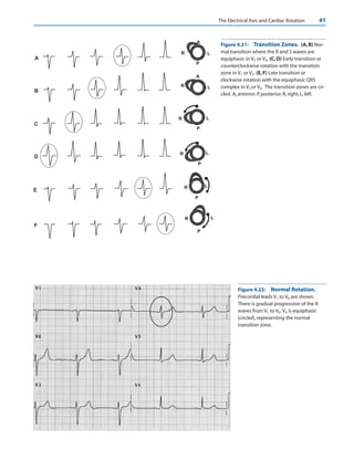 basic and bedside ECG.pdf