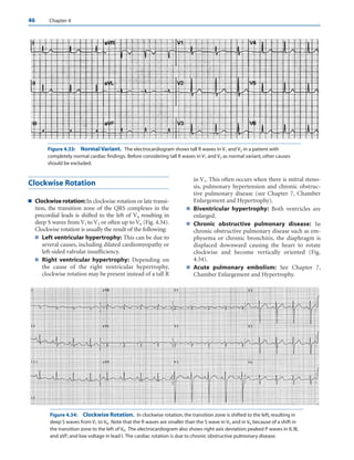 basic and bedside ECG.pdf
