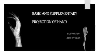 BASIC AND SUPPLEMENTARY
PROJECTION OF HAND
BIJOY PETER
BMIT 2ND YEAR
 