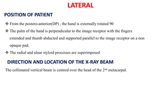 LATERAL
POSITION OF PATIENT
 From the postero-anterior(DP) , the hand is externally rotated 90
 The palm of the hand is perpendicular to the image receptor with the fingers
extended and thumb abducted and supported parallel to the image receptor on a non
opaque pad.
 The radial and ulnar styloid processes are superimposed
DIRECTION AND LOCATION OF THE X-RAY BEAM
The collimated vertical beam is centred over the head of the 2nd metacarpal.
 