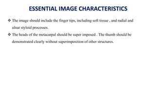 ESSENTIAL IMAGE CHARACTERISTICS
 The image should include the finger tips, including soft tissue , and radial and
ulnar styloid processes.
 The heads of the metacarpal should be super imposed . The thumb should be
demonstrated clearly without superimposition of other structures.
 