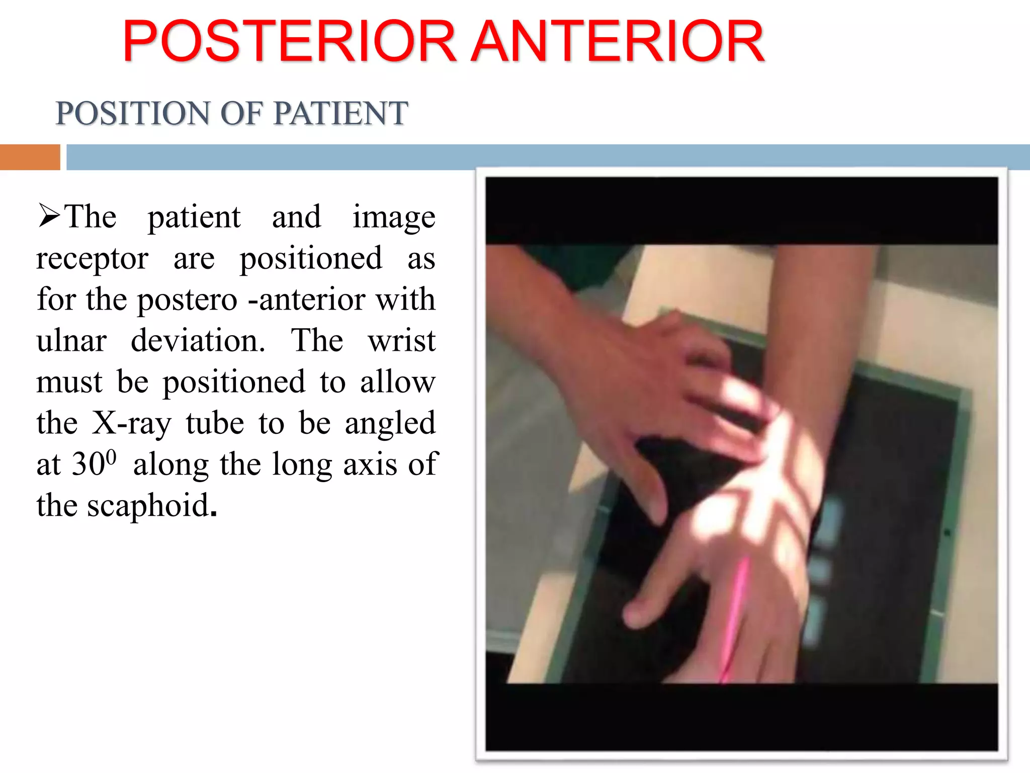 Basic and supplementary projections of thumb and scaphoid | PPTX