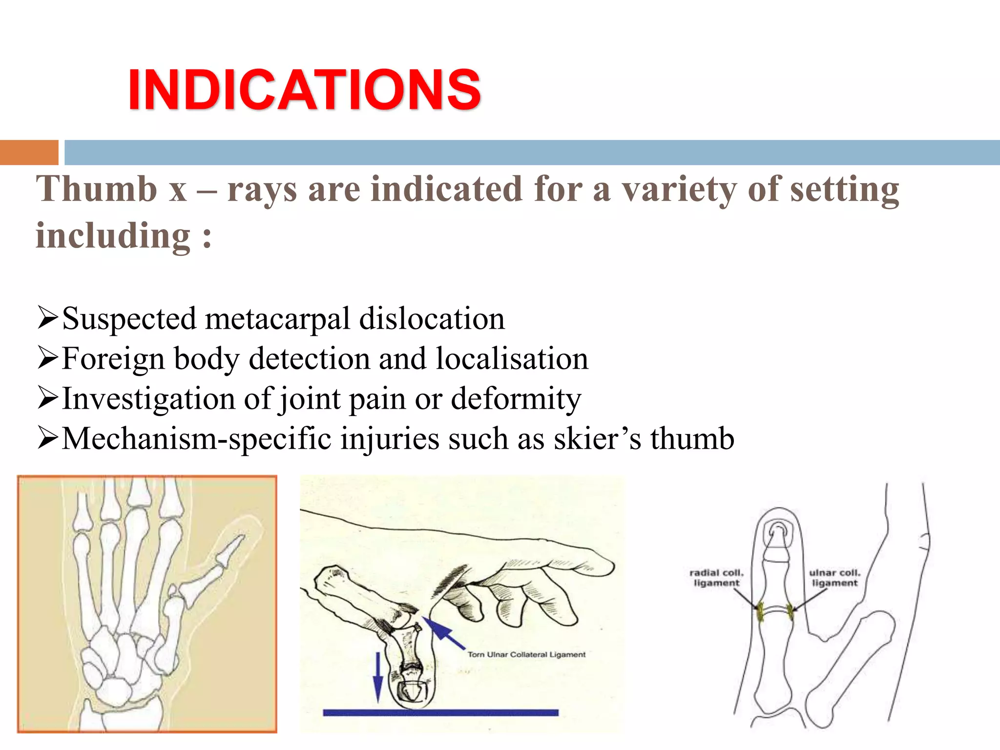 Basic and supplementary projections of thumb and scaphoid | PPTX