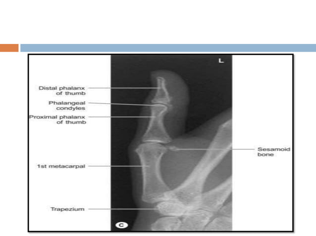 Basic and supplementary projections of thumb and scaphoid | PPTX