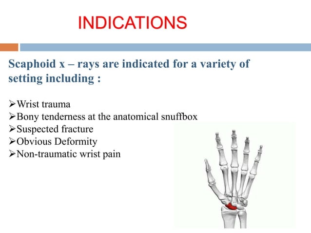 Basic and supplementary projections of thumb and scaphoid | PPTX