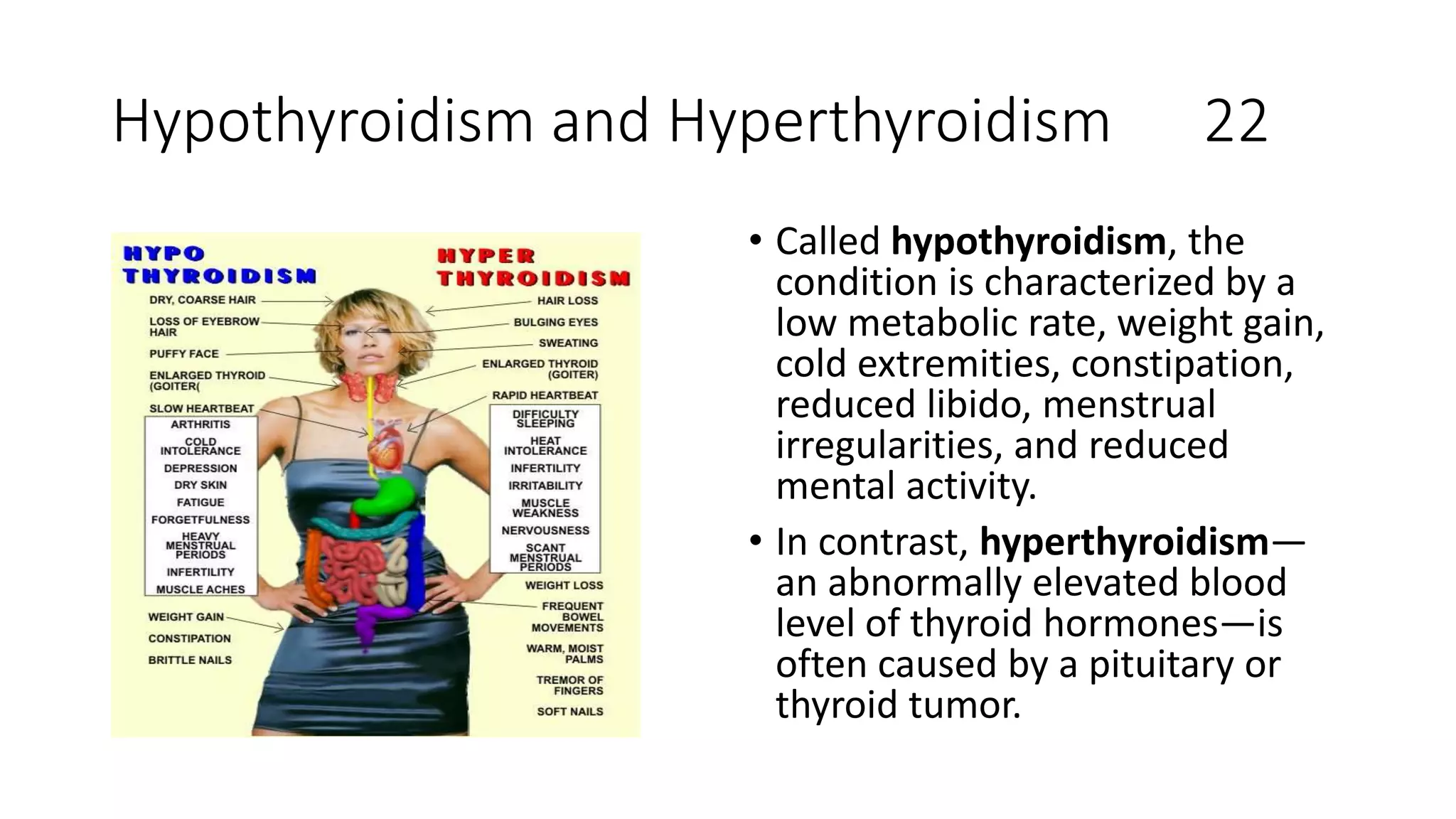 Hypothyroidism and Hyperthyroidism 22
• Called hypothyroidism, the
condition is characterized by a
low metabolic rate, weight gain,
cold extremities, constipation,
reduced libido, menstrual
irregularities, and reduced
mental activity.
• In contrast, hyperthyroidism—
an abnormally elevated blood
level of thyroid hormones—is
often caused by a pituitary or
thyroid tumor.
 