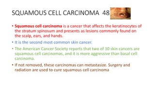 SQUAMOUS CELL CARCINOMA 48
• Squamous cell carcinoma is a cancer that affects the keratinocytes of
the stratum spinosum and presents as lesions commonly found on
the scalp, ears, and hands.
• It is the second most common skin cancer.
• The American Cancer Society reports that two of 10 skin cancers are
squamous cell carcinomas, and it is more aggressive than basal cell
carcinoma.
• If not removed, these carcinomas can metastasize. Surgery and
radiation are used to cure squamous cell carcinoma
 