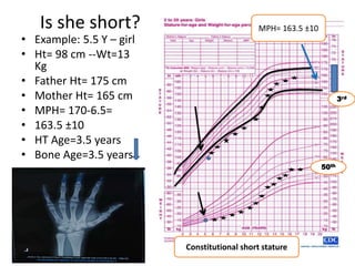 Basic approach on short stature in children | PPTX