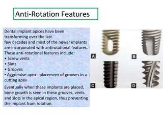 Anti-Rotation Features
Dental implant apices have been
transforming over the last
few decades and most of the newer implants
are incorporated with antirotational features.
These anti-rotational features include:
• Screw vents
• Slots
• Grooves
• Aggressive apex : placement of grooves in a
cutting apex
Eventually when these implants are placed,
bone growth is seen in these grooves, vents
and slots in the apical region, thus preventing
the implant from rotation.
 
